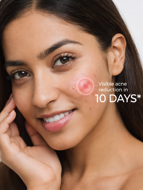 HealEvar Anti Acne Face Wash – Salicylic Acid + Vitamin E | Daily Purifying Cleanser | Oil Control & Clear Skin (110ml)